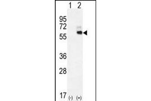 Western blot analysis of KNG1 (arrow) using rabbit polyclonal KNG1 Antibody (N-term) (ABIN655629 and ABIN2845108). (KNG1 Antikörper  (N-Term))