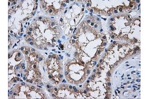 Immunohistochemical staining of paraffin-embedded Kidney tissue using anti-AKT2mouse monoclonal antibody. (AKT2 Antikörper)