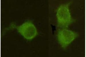 Immunocytochemistry stain of Hela using Mannose Phosphate Isomerase mouse mAb (1:300). (MPI Antikörper)