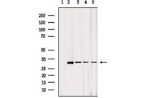 Western blot analysis of extracts from various samples, using MRPL2 Antibody. (MRPL2 Antikörper  (C-Term))