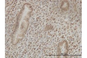 Immunoperoxidase of monoclonal antibody to CSTF2 on formalin-fixed paraffin-embedded human endometrium tissue.