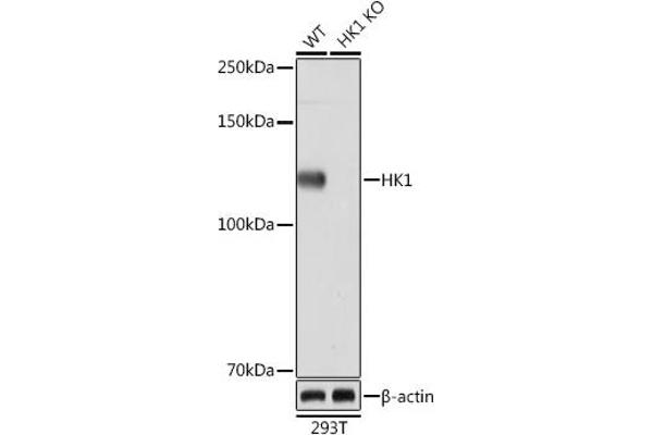 Hexokinase 1 Antikörper