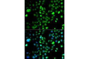 Immunofluorescence analysis of A549 cells using PRDM5 antibody (ABIN5975510). (PRDM5 Antikörper)