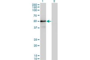 Western Blot analysis of SMAD3 expression in transfected 293T cell line by SMAD3 monoclonal antibody (M20), clone 4F9. (SMAD3 Antikörper  (AA 147-270))