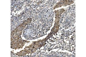 IHC analysis of Claudin 3/CLDN3 using anti-Claudin 3/CLDN3 antibody (ABIN7599626). (Claudin 3 Antikörper  (AA 101-220))