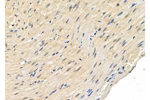 ABIN6262765 and ABIN6278912 at 1/100 staining Rat heart tissue by IHC-P. (KDM5A Antikörper  (C-Term))