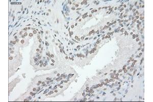 Image no. 14 for anti-Glial Fibrillary Acidic Protein (GFAP) antibody (ABIN1498440)