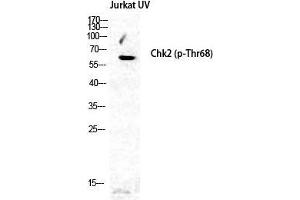 Western Blot (WB) analysis of specific cells using Phospho-Chk2 (T68) Polyclonal Antibody. (CHEK2 Antikörper  (pThr68))