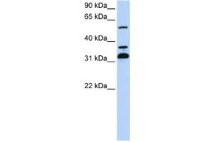 Western Blotting (WB) image for anti-Tripartite Motif Containing 9 (TRIM9) antibody (ABIN2458110) (TRIM9 Antikörper)