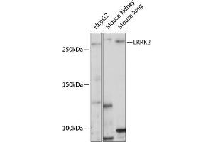 Western blot analysis of extracts of various cell lines, using LRRK2 Polyclonal Antibody  at 1:1000 dilution. (LRRK2 Antikörper  (AA 2355-2527))