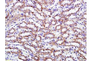 Immunohistochemistry (Paraffin-embedded Sections) (IHC (p)) image for anti-ADAM Metallopeptidase Domain 17 (ADAM17) (AA 201-300) antibody (ABIN705671)