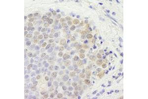 Immunohistochemistry (IHC) image for anti-GATA Zinc Finger Domain Containing 2B (GATAD2B) (AA 50-100) antibody (ABIN7448709) (GATAD2B Antikörper  (AA 50-100))