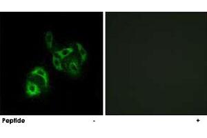 Immunofluorescence analysis of A-549 cells, using SLC27A4 polyclonal antibody . (SLC27A4 Antikörper)
