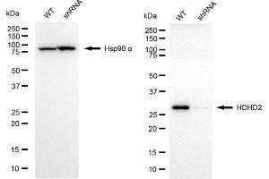 Western blotting analysis using HDHD2 antibody (ABIN7798835). (HDHD2 Antikörper)