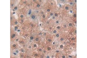IHC-P analysis of Human Tissue, with DAB staining. (ODC1 Antikörper  (AA 234-453))