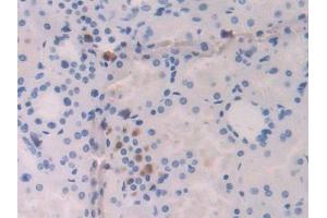 Used in DAB staining on fromalin fixed paraffin- embedded kidney tissue (IL-18 Antikörper  (AA 37-193))