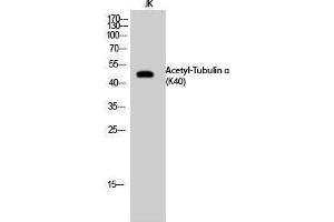 Western Blotting (WB) image for anti-alpha Tubulin (TUBA1) (acLys40) antibody (ABIN6285491) (alpha Tubulin Antikörper  (acLys40))