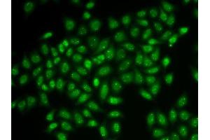 Immunofluorescence analysis of HeLa cells using COIL antibody. (Coilin Antikörper  (AA 297-576))