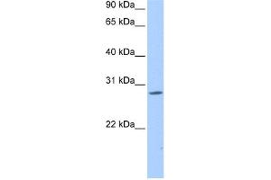 WB Suggested Anti-NRIP3 Antibody Titration:  0. (NRIP3 Antikörper  (Middle Region))