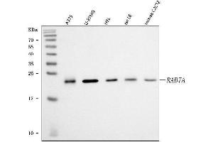 Western blot analysis of RAB7/RAB7A using anti-RAB7/RAB7A antibody (ABIN7600597).