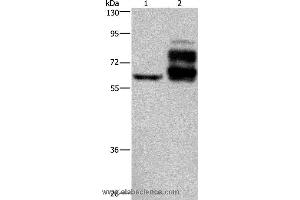 Western blot analysis of Jurkat cell and human rectal cancer tissue, using PCSK9 Polyclonal Antibody at dilution of 1:200 (PCSK9 Antikörper)