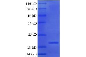 SDS-PAGE (SDS) image for Ephrin A5 (EFNA5) (AA 21-203) protein (His tag) (ABIN5709445)