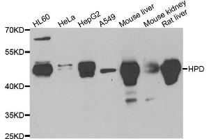 Western blot analysis of extracts of various cell lines, using HPD antibody (ABIN5973894) at 1/1000 dilution. (HPD Antikörper)