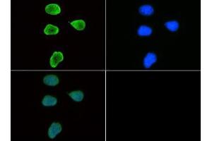 Fluorescence Microscopy (FM) image for anti-Histone 3 (H3) (H3K9me3) antibody (ABIN5706787)