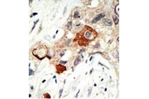 Image no. 1 for anti-Ubiquitin-Conjugating Enzyme E2I (UBE2I) (N-Term) antibody (ABIN356594) (UBE2I Antikörper  (N-Term))