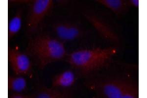 Immunofluorescence staining of methanol-fixed Hela cells using PAK1/PAK2/PAK3(Phospho-Thr423/Thr402/Thr421) Antibody. (PAK1/2/3 Antikörper  (pThr423))