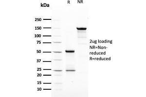 SDS-PAGE Analysis Purified HER-2 Mouse Monoclonal Antibody (ERBB2/3079). (ErbB2/Her2 Antikörper  (AA 311-462))
