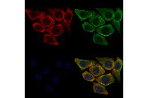 ABIN6260556 and ABIN6272680 staining HepG2 cells by IF/ICC.