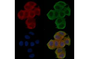ABIN6257854 and ABIN6276062 staining Hela cells(30 min of UV treatment) by IF/ICC. (NPY2R Antikörper  (N-Term))