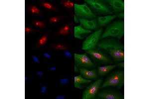 ABIN6259751 and ABIN6278986 staining  cells by IF/ICC. (Actin-Like 6B Antikörper  (Internal Region))