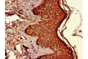 Immunohistochemistry of paraffin-embedded human skin tissue using ABIN7174224 at dilution of 1:100