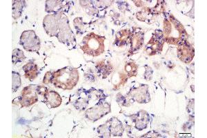 Formalin-fixed and paraffin embedded human larynx labeled with Rabbit Anti-MFSD2A Polyclonal Antibody, Unconjugated  at 1:200 followed by conjugation to the secondary antibody and DAB staining (MFSD2A Antikörper  (AA 331-430))