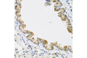 Immunohistochemistry of paraffin-embedded mouse lung using CDKN2C antibody (ABIN5971074) at dilution of 1/100 (40x lens). (CDKN2C Antikörper)