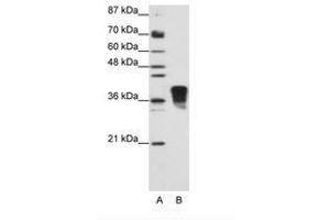 Image no. 2 for anti-Transformer 2 beta Homolog (TRA2B) (N-Term) antibody (ABIN202162) (TRA2B Antikörper  (N-Term))
