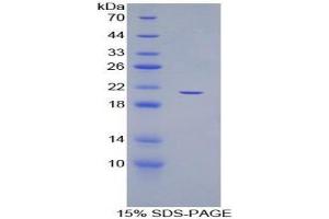 SDS-PAGE analysis of Human ADAMTS12 Protein.