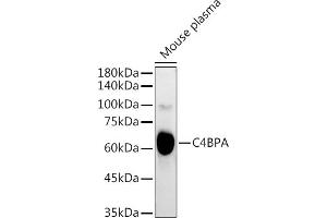 Western blot analysis of extracts of Mouse plasma, using C4BPA antibody (ABIN6134574, ABIN6137773, ABIN6137774 and ABIN6223565) at 1:3000 dilution. (C4BPA Antikörper  (C-Term))