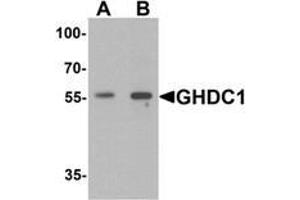Western blot analysis of GHDC in 293 cell lysate with GHDC antibody at  (A) 0. (GHDC Antikörper  (N-Term))
