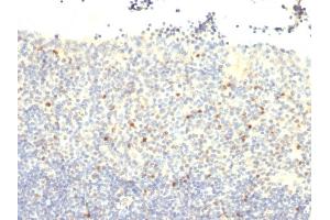 Formalin-fixed, paraffin-embedded human Tonsil stained with FOXP3 Monoclonal Antibody (FXP3/197).