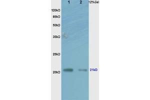 L1 human colon carcinoma lysates L2 rat brain lysates probed with Anti RhoA Polyclonal Antibody, Unconjugated (ABIN738846) at 1:200 overnight at 4 °C. (RhoA, C (AA 101-193) Antikörper)