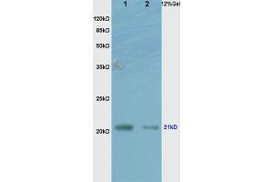 L1 human colon carcinoma lysates L2 rat brain lysates probed with Anti RhoA Polyclonal Antibody, Unconjugated (ABIN738846) at 1:200 overnight at 4 °C. (RhoA/ C (AA 101-193) Antikörper)