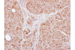 IHC-P Image Immunohistochemical analysis of paraffin-embedded SW480 xenograft, using TRAF1, antibody at 1:100 dilution.