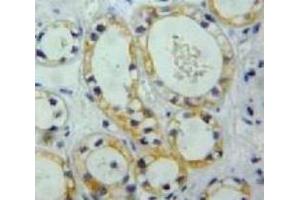 Immunohistochemistry (IHC) image for anti-Nephrosis 1, Congenital, Finnish Type (Nephrin) (NPHS1) (AA 39-144) antibody (ABIN7432919)