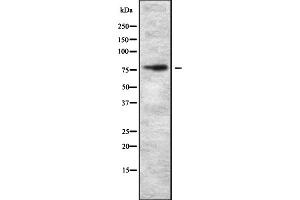 Western blot analysis of ZNF750 expression in HEK293 cells ,The lane on the left is treated with the antigen-specific peptide.