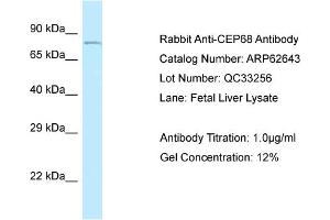 Western Blotting (WB) image for anti-Centrosomal Protein 68kDa (CEP68) (N-Term) antibody (ABIN2789197) (CEP68 Antikörper  (N-Term))