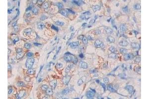 Immunohistochemistry (IHC) image for anti-Membrane Metallo-Endopeptidase (MME) (AA 382-538) antibody (ABIN7434053)