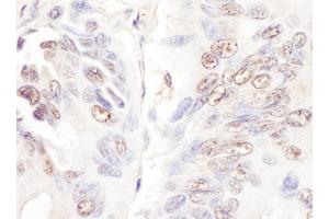 Immunohistochemistry (IHC) image for anti-Cyclin-Dependent Kinase-Like 5 (CDKL5) (AA 350-400) antibody (ABIN7453908)